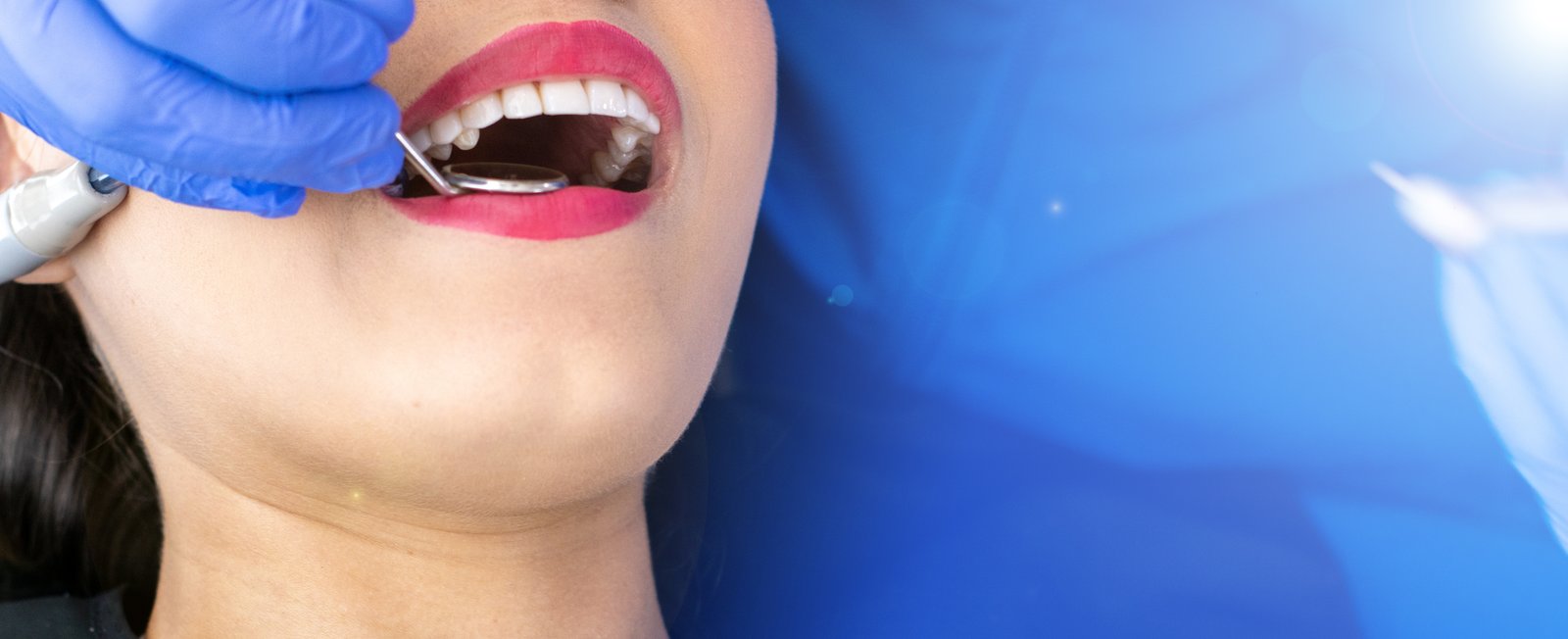 Teeth Cleaning