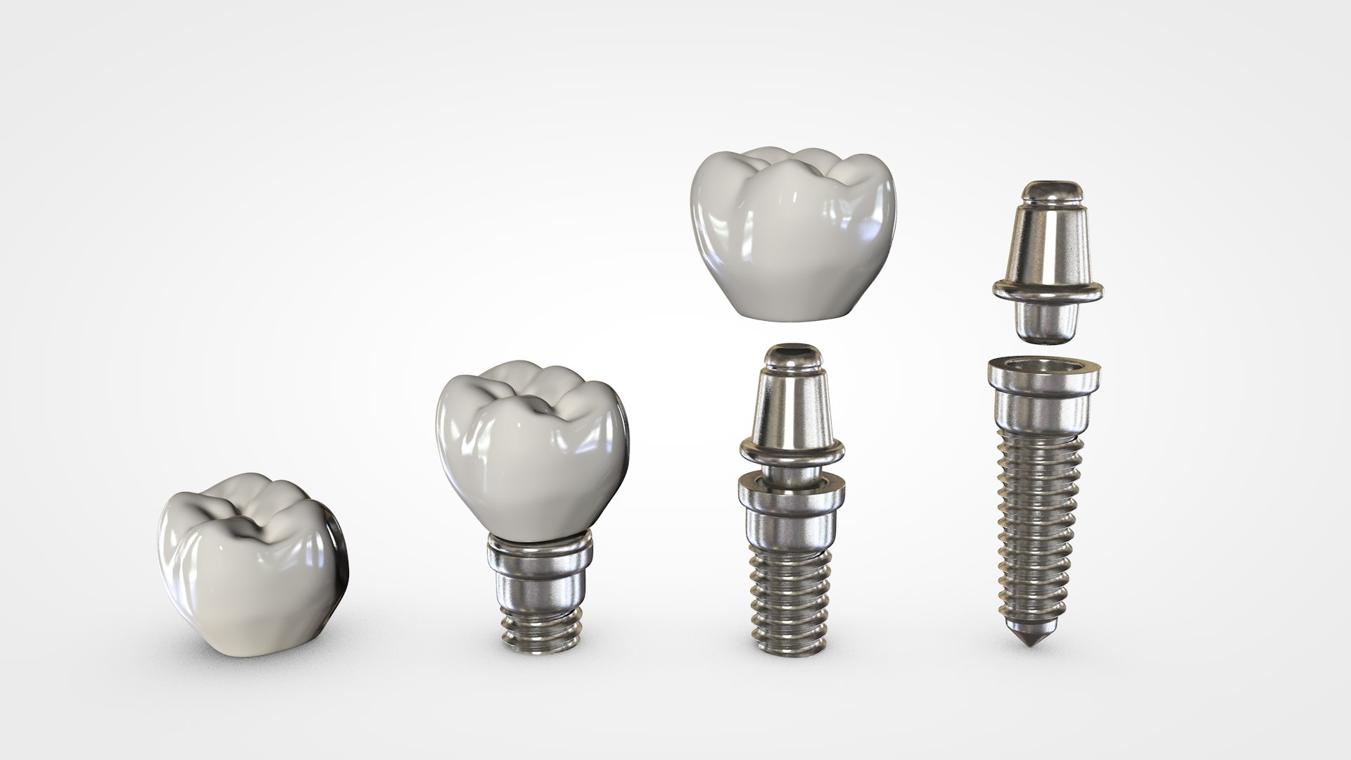 Discover The Benefits Of Dental Implants